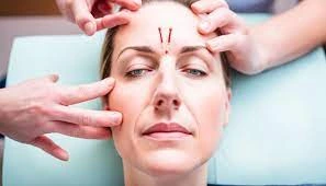 Bell’s Palsy – Causes, Symptoms, and Physiotherapy in Multan