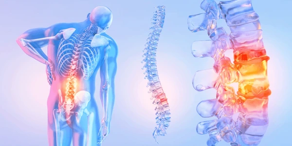 Chronic Neck and Back Pain – Causes, Treatment, and Physiotherapy in Multan